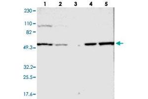 Western blot analysis of Lane 1: RT-4, Lane 2: U-251 MG, Lane 3: Human Plasma, Lane 4: Liver, Lane 5: Tonsil with LMAN1 polyclonal antibody .