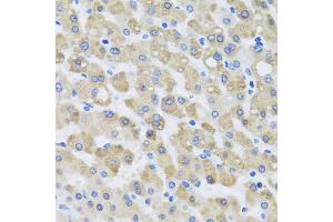 Immunohistochemistry of paraffin-embedded human liver injury using SNAP29 antibody. (SNAP29 anticorps)