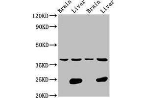 Western Blot Positive WB detected in: Rat brain tissue, Rat liver tissue, Mouse brain tissue, Mouse liver tissue All lanes: LSAMP antibody at 4. (LSAMP anticorps  (AA 168-287))