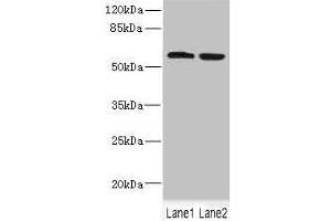 Western blot All lanes: FTCD antibody at 5. (FTCD anticorps  (AA 412-541))