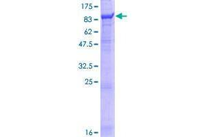 Image no. 1 for Bardet-Biedl Syndrome 12 (BBS12) (AA 1-710) protein (GST tag) (ABIN1346469)