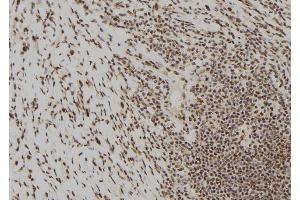 ABIN6277474 at 1/100 staining Human gastric tissue by IHC-P.