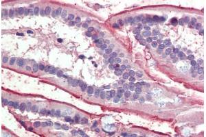 Small intestine, Human: Formalin-Fixed, Paraffin-Embedded (FFPE) (SLC5A1 anticorps  (AA 458-472))