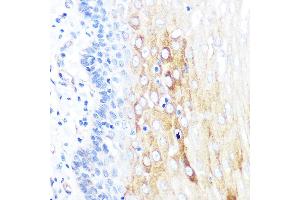 Immunohistochemistry of paraffin-embedded human esophageal using ROCK2 Rabbit mAb (ABIN7269972) at dilution of 1:100 (40x lens). (ROCK2 anticorps)