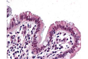 Anti-SMARCB1 antibody IHC of human colon.