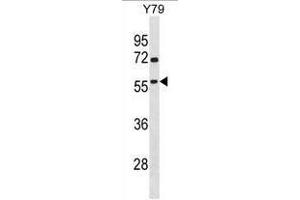 TAF1A Antibody (N-term) western blot analysis in Y79 cell line lysates (35µg/lane).