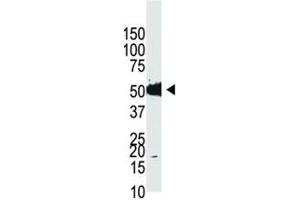 Western blot analysis of Dnmt2 antibody and HL-60 cell lysate