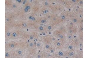 Detection of SP140 in Human Liver Tissue using Polyclonal Antibody to Sp140 Nuclear Body Protein (SP140)