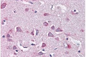 Human Brain, Cortex (formalin-fixed, paraffin-embedded) stained with NF2 antibody ABIN337064 at 5 ug/ml followed by biotinylated anti-goat IgG secondary antibody ABIN481715, alkaline phosphatase-streptavidin and chromogen. (Merlin anticorps  (AA 526-536))