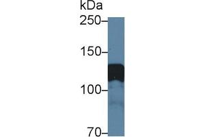 Detection of AMPH in Rat Cerebrum lysate using Polyclonal Antibody to Amphiphysin (AMPH) (Amphiphysin anticorps  (AA 24-240))