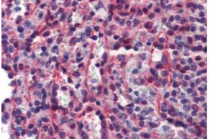 Human Spleen (formalin-fixed, paraffin-embedded) stained with CASP7 antibody ABIN462356 followed by biotinylated anti-mouse IgG secondary antibody ABIN481714, alkaline phosphatase-streptavidin and chromogen.