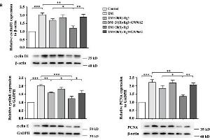 Differential effects of the 20(R/S)-Rg3 stereoisomers on proliferation of VSMCs within plaques. (PCNA anticorps  (AA 201-261))