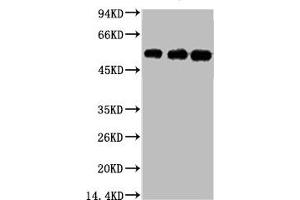 Western blot analysis of 1) Hela, 2) Mouse Brain tissue, 3) Rat Brain tissue, diluted at 1:5000. (TUBB3 anticorps)