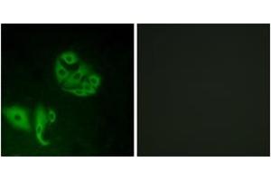 Immunofluorescence analysis of A549 cells, using GPR20 Antibody. (GPR20 anticorps  (AA 291-340))