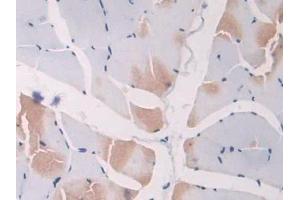 DAB staining on IHC-P; Samples: Rat Skeletal muscle Tissue