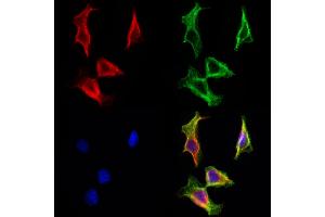 ABIN6263468 and ABIN6272966 staining Hela cells by IF/ICC. (MYH7 anticorps  (C-Term))