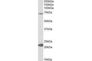 Western Blotting (WB) image for anti-Potassium Intermediate/small Conductance Calcium-Activated Channel, Subfamily N, Member 2 (KCNN2) (Internal Region) antibody (ABIN2464352) (KCNN2 anticorps  (Internal Region))