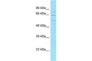 WB Suggested Anti-Wasf2 Antibody   Titration: 1. (WASF2 anticorps  (Middle Region))