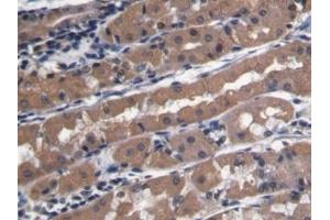 Detection of PECAM1 in Human Stomach Tissue using Polyclonal Antibody to Platelet/Endothelial Cell Adhesion Molecule (PECAM1)