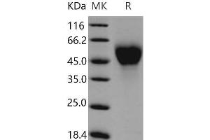 Western Blotting (WB) image for Interleukin 2 Receptor, alpha (IL2RA) protein (His tag) (ABIN7320330)