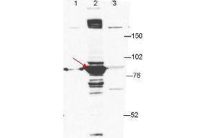 Anti-ESRP-1 by western blot shows detection of ESRP-1 in transfected 293T cell extracts (lane 2, arrowhead). (ESRP1 anticorps)