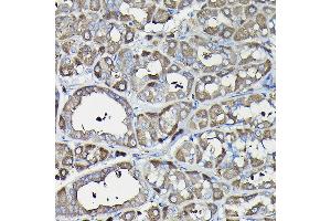 Immunohistochemistry of paraffin-embedded rat liver using Ferritin Heavy Chain Rabbit pAb (ABIN3021538, ABIN3021539, ABIN3021540 and ABIN6215218) at dilution of 1:100 (40x lens).