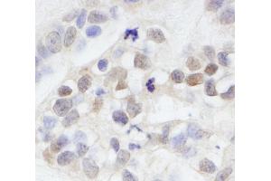 anti-Melanoma Antigen Family D, 2 (MAGED2) (AA 50-100) antibody