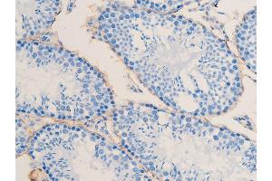 ABIN6267068 at 1/100 staining mouse testis tissue sections by IHC-P. (Smooth Muscle Actin anticorps  (N-Term))