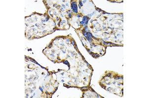 Immunohistochemistry of paraffin-embedded human placenta using TLR3 Rabbit pAb (ABIN6130066, ABIN6149219, ABIN6149220 and ABIN6215465) at dilution of 1:100 (40x lens). (TLR3 anticorps  (AA 464-647))