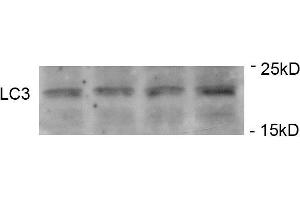 Immunoblots of SH-SY5Y cells treated with P+ for 24h was probed with (ABIN389699 and ABIN2839660). (LC3C anticorps  (pSer12))