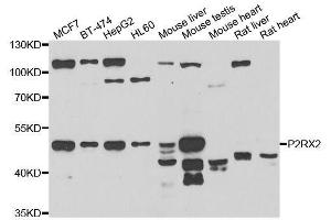 Western blot analysis of extracts of various cell lines, using P2RX2 antibody. (P2RX2 anticorps  (AA 60-320))