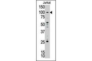 Western blot analysis of MLLT10 polyclonal antibody  in Jurkat cell lysate. (MLLT10 anticorps  (C-Term))