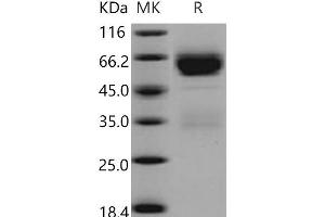 Western Blotting (WB) image for serpin Peptidase Inhibitor, Clade A (Alpha-1 Antiproteinase, Antitrypsin), Member 11 (SERPINA11) protein (His tag) (ABIN7320279)