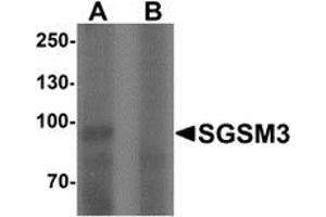 Western blot analysis of SGSM3 in 293 cell lysate with SGSM3 Antibody  at 1 ug/mL in (A) the absence and (B) the presence of blocking peptide.