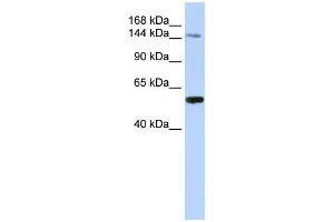 WB Suggested Anti-EDC4 Antibody Titration: 0.