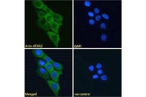 ABIN570879 Immunofluorescence analysis of paraformaldehyde fixed A431 cells, permeabilized with 0. (Ataxin 2 anticorps  (Internal Region))
