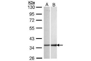 WB Image Sample (30 ug of whole cell lysate) A: 293T B: Hep G2 , 10% SDS PAGE antibody diluted at 1:1000 (ECHS1 anticorps)