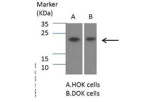 WB Image Sample (30 ug of whole cell lysate) A: Hep G2 , 12% SDS PAGE antibody diluted at 1:1000 (SOCS1 anticorps  (C-Term))