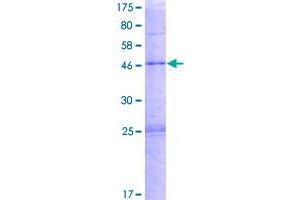 phospholipase A2, Group IVD (Cytosolic) (PLA2G4D) (AA 1-216) protein (GST tag)