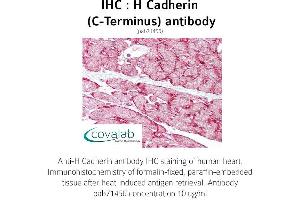Image no. 1 for anti-Cadherin 13 (CDH13) (C-Term) antibody (ABIN5693589) (Cadherin 13 anticorps  (C-Term))