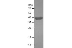 Western Blotting (WB) image for Annexin A6 (ANXA6) (AA 324-673) protein (His tag) (ABIN7121848) (ANXA6 Protein (AA 324-673) (His tag))