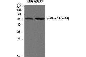Western Blot (WB) analysis of K562 AD293 using Phospho-MEF-2D (S444) antibody. (MEF2D anticorps  (pSer444))