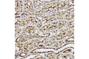 Immunohistochemistry of paraffin-embedded rat liver using [KO Validated] Heme Oxygenase 1 (HO-1/HMOX1) Rabbit pAb (ABIN6131781, ABIN6141881, ABIN6141883 and ABIN6215065) at dilution of 1:50 (40x lens). (HMOX1 anticorps  (AA 1-288))