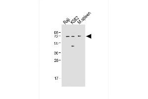 All lanes : Anti-IRAK3 Antibody (N-term) at 1:500 dilution Lane 1: Raji whole cell lysate Lane 2: K562 whole cell lysate Lane 3: Mouse spleen tissue lysate Lysates/proteins at 20 μg per lane. (IRAK3 anticorps  (N-Term))