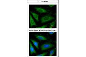 Image no. 3 for anti-Glyceraldehyde-3-Phosphate Dehydrogenase (GAPDH) antibody (ABIN467389) (GAPDH anticorps)