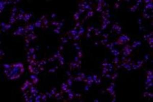Immunofluorescent analysis of paraformaldehyde-fixed rat lung using,RPAP2 (ABIN7075481) at dilution of 1: 1000