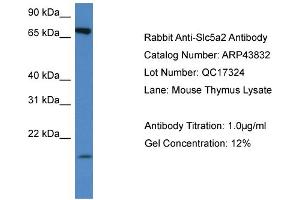 Western Blotting (WB) image for anti-Solute Carrier Family 5 (Sodium/glucose Cotransporter), Member 2 (SLC5A2) (Middle Region) antibody (ABIN2781579)