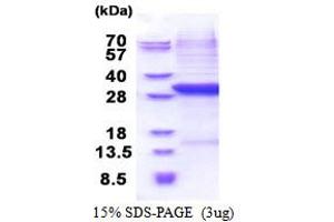 SDS-PAGE (SDS) image for Complement Factor B (CFB) (AA 26-259) protein (His tag) (ABIN5853522) (Complement Factor B Protein (CFB) (AA 26-259) (His tag))