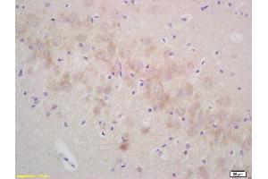 Formalin-fixed and paraffin embedded rat brain labeled with Rabbit Anti gamma Synuclein Polyclonal Antibody, Unconjugated (ABIN671001) at 1:200 followed by conjugation to the secondary antibody and DAB staining (SNCG anticorps  (AA 2-123))