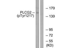 Western blot analysis of extracts from Jurkat cells treated with UV 15', using PLCG2 (Phospho-Tyr1217) Antibody. (Phospholipase C gamma 2 anticorps  (pTyr1217))